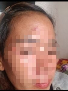 Cemburu Buta, Wanita di Kosambi Diduga Aniaya Kekasih Baru Mantan Suami
